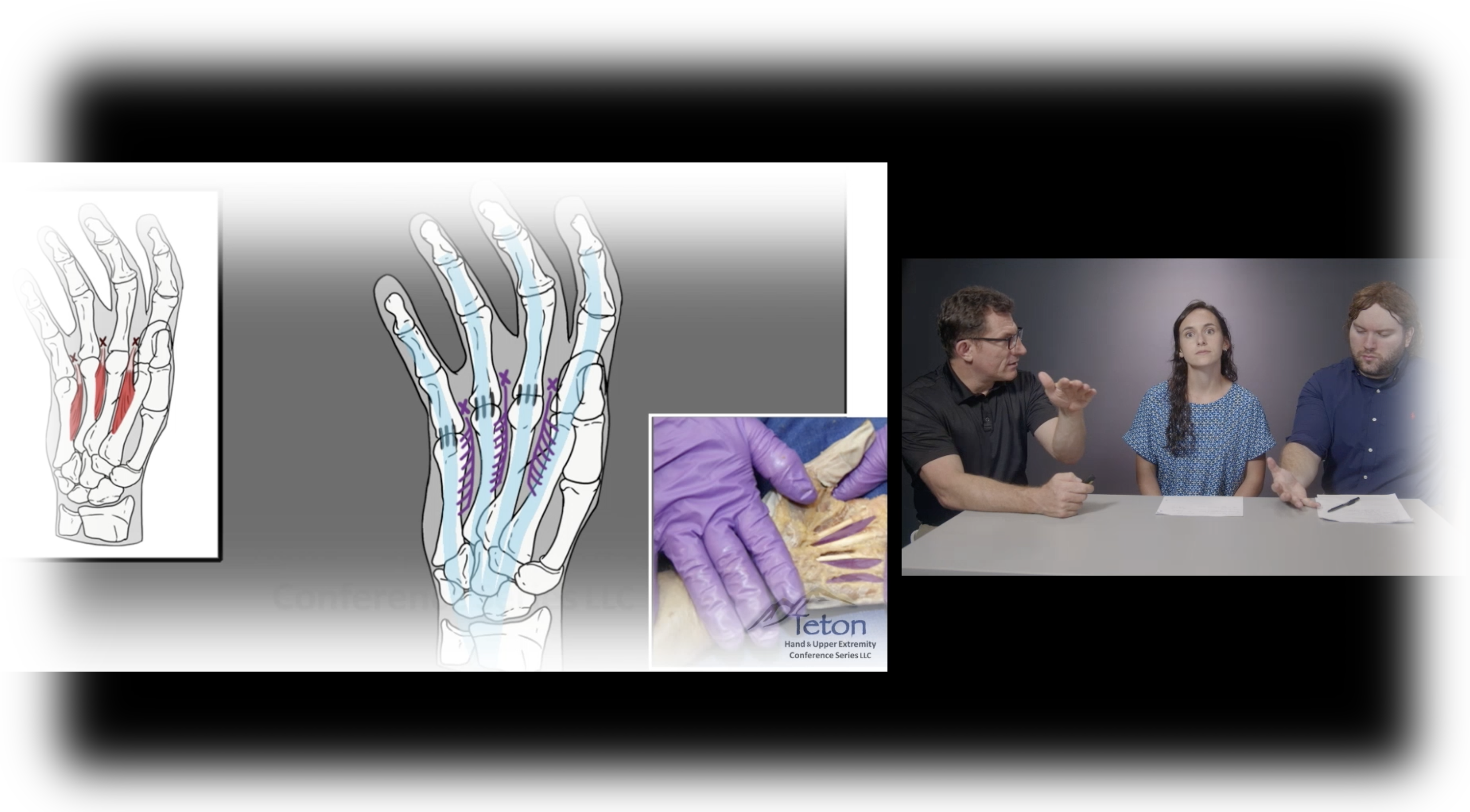 Hand Processes The Human Hand: A Study of the Anatomy and the Anatomical Relationships ...